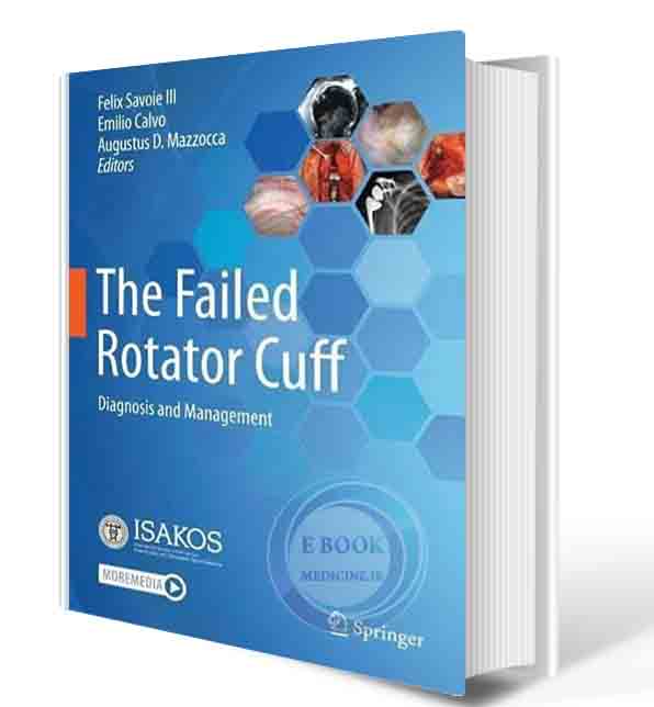 دانلود کتابThe Failed Rotator Cuff: Diagnosis and Management 1st ed. 20212021 (ORIGINAL PDF)